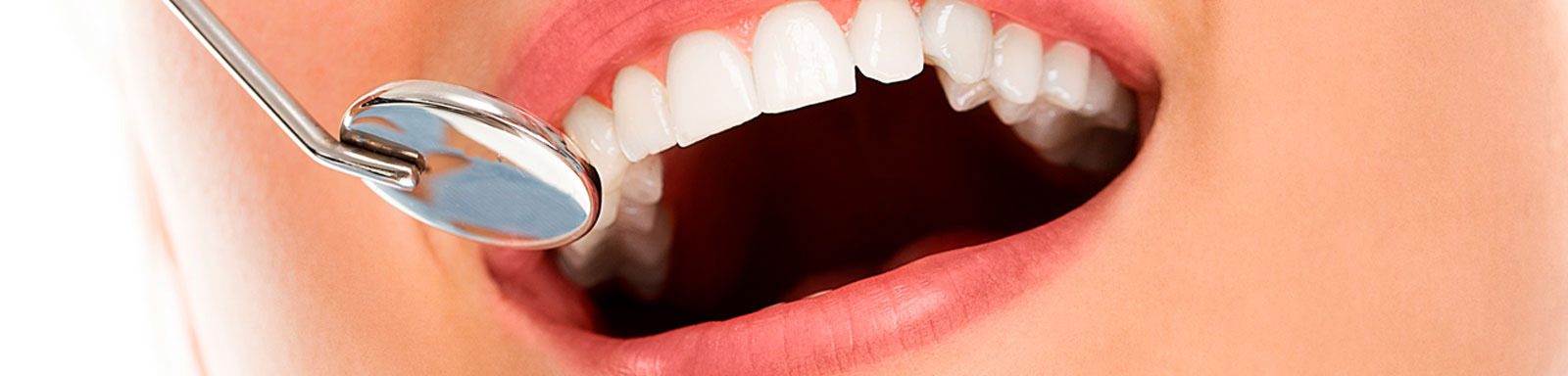 Tratamento - Odontologia Estética